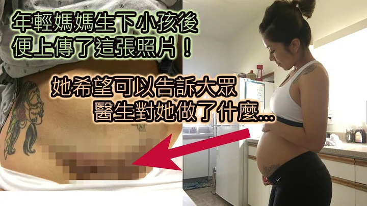 (重传)年轻妈妈生下小孩后便上传了这张照片，她希望可以告诉大众医生对她做了什么… - 天天要闻