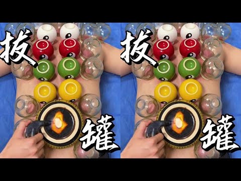 Another sunflower Immersive stress-relief experience of cupping