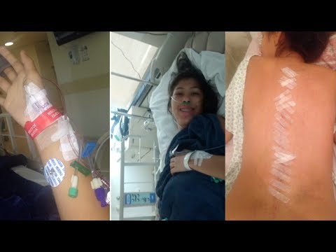 Video Cirurgia de Escoliose - Quanto Custa? Convênio ou Sus? - youtube
