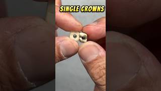 Crowns can be Slippery. Try this TIP.