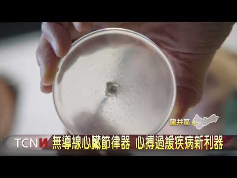 無導線心臟節律器 心搏過緩疾病新利器-大台中新聞
