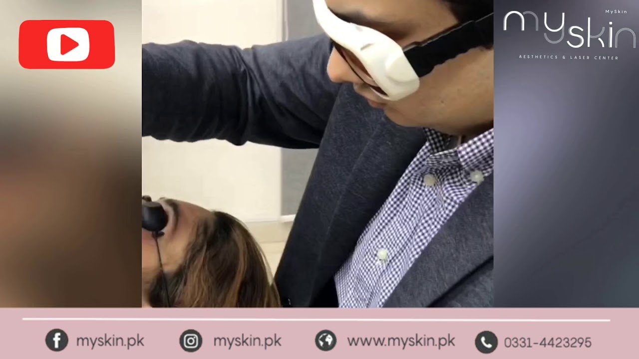 Review Best Melasma/freckle treatment with Laser in Lahore