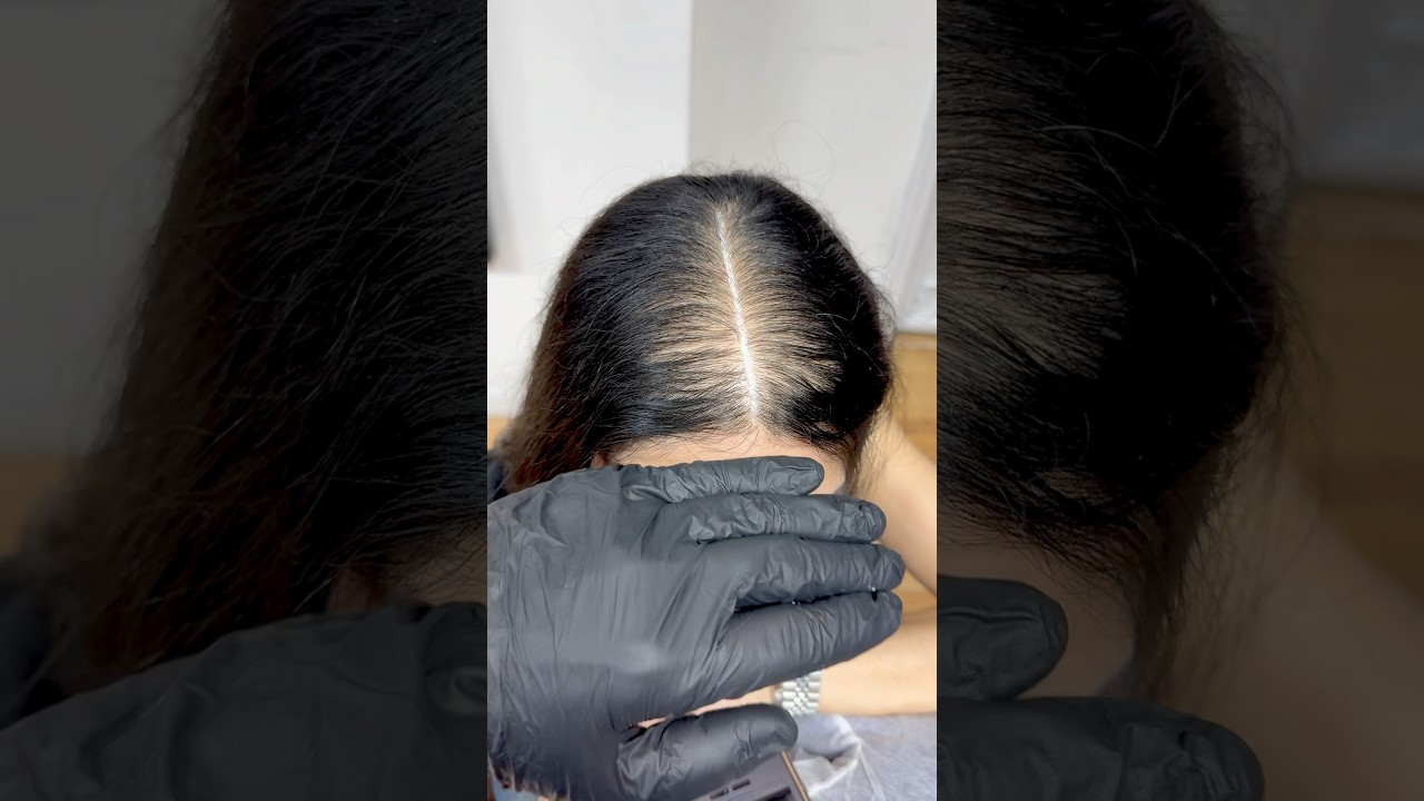 UNBELIEVABLE WOMAN HAIR LOSS TREATMENT 💯 Guaranteed