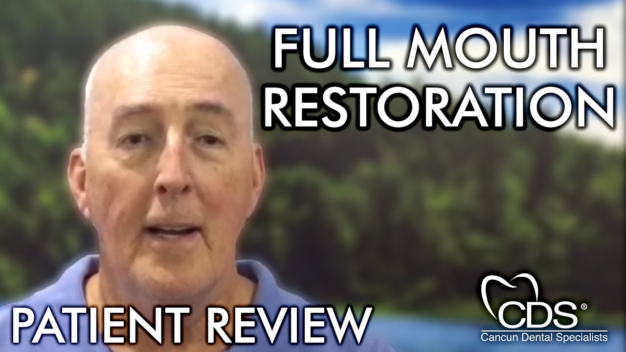 Perfect Smile After Full Mouth Restoration in Mexico: Bill's Story  | Cancun Dental Specialists