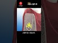 사랑니 부위에 고름? #shorts