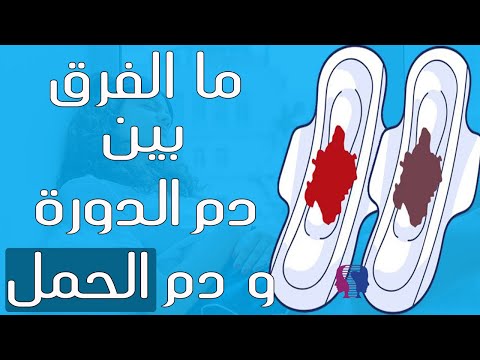 فيديو: أثناء الحمل كيف تتعرفين على نزيف الانغراس؟