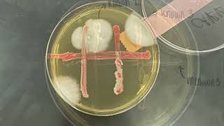 Proficiency - Identifying Yeast Mutations through Complementation