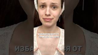 Как избавиться от прыщей спине и плечах прыщи высыпания энзимнаяпудра сыворотка бьюти уход