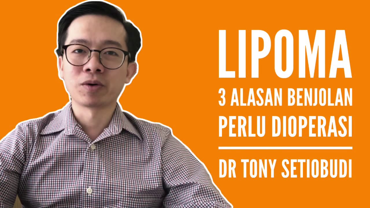 LIPOMA - 3 ALASAN BENJOLAN PERLU DIOPERASI