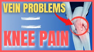 CAN VEIN PROBLEMS (VARICOSE) CAUSE KNEE PAIN ?