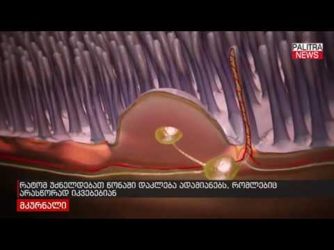 რატომ უძნელდებად წონაში დაკლება ადამიანებს, რომლებიც არასწორად იკვებებიან