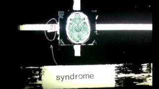 Syndrome - For You