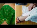 Fancy sleeves design cutting✂️and stitching🪡 blouse sleeves design cutting and stitching बाजू डिजाइन