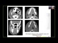 Head & Neck Imaging Part 3| Health4TheWorld Academy