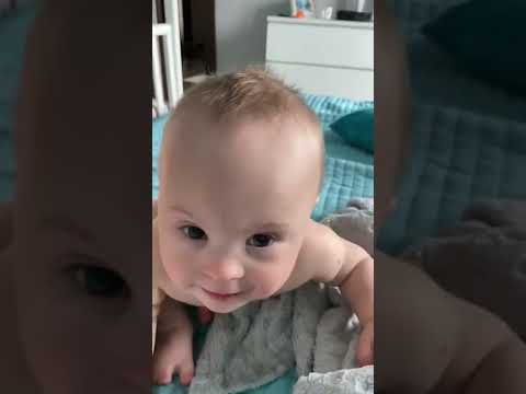 Video: Kako dojiti bebu s Downovim sindromom