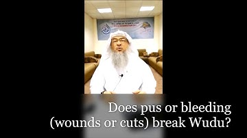 Does pus or bleeding (wounds or cuts) break Wudu? | Sheikh Assim Al Hakeem