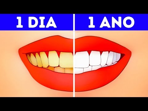 Vídeo: A escova de dentes é um terreno fértil para bactérias perigosas