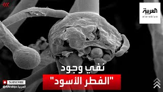 الحكومة المصرية تنفي انتشار مرض الفطر الأسود