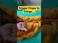 Trigger finger in telugudr sai chandra mbbs dnb ortho