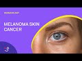 Melanoma Skin Cancer Overview [Dermatology]