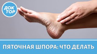 видео: Что делать, если у вас пяточная шпора картинка: Что делать, если у вас пяточная шпора