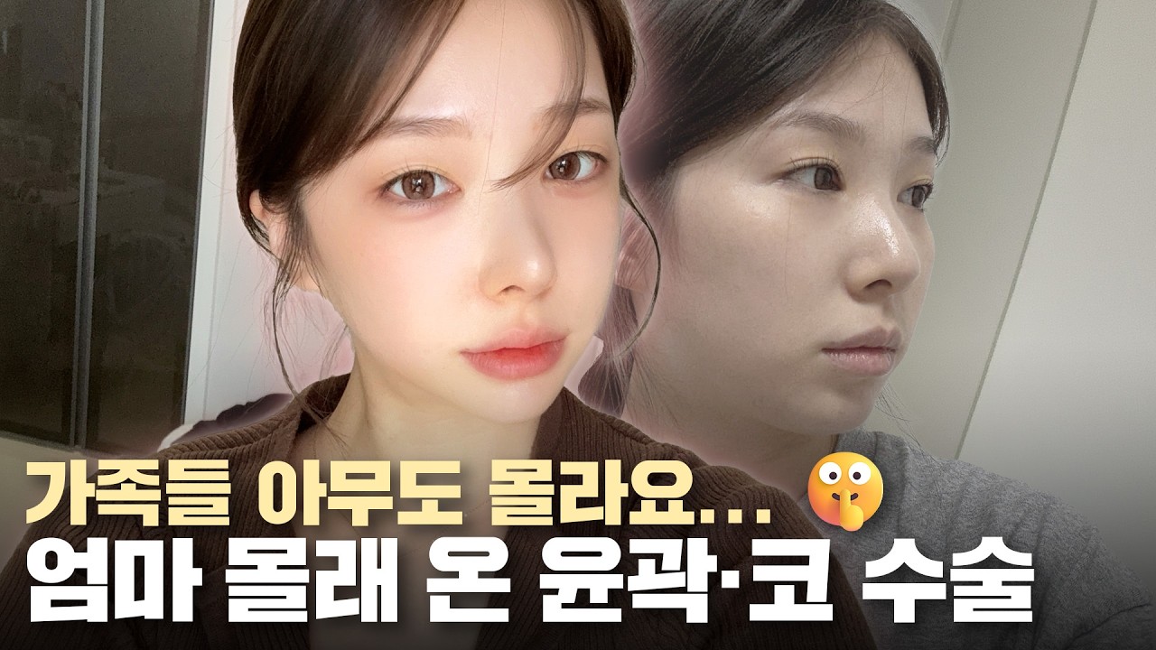 리;모델링 ㅣ "부모님은 아무도 몰라요..." 가족 몰래 윤곽+코 수술받으러 온 이유 🤫 ㅣ 비티성형외과