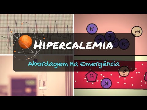 Vídeo: 5 Sinais E Sintomas Que Você Pode Ter Hipercalemia