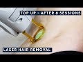 Top Up after 8 sessions of Laser Hair Removal