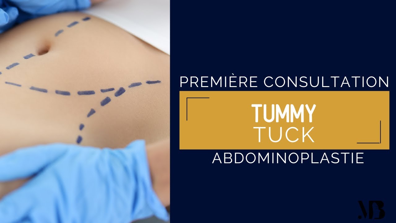 Première consultation : Tummy Tuck (abdominoplastie)