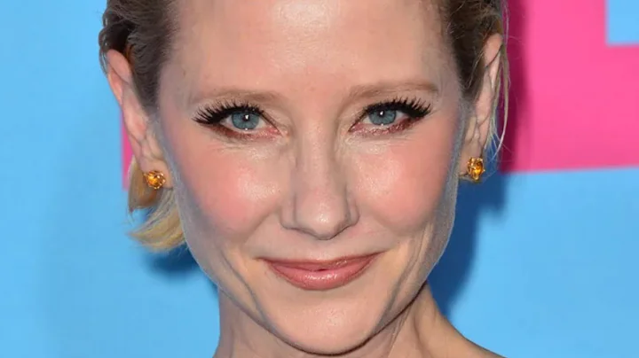 Anne Heche Suffers Severe Injuries In Fiery Car Cr...