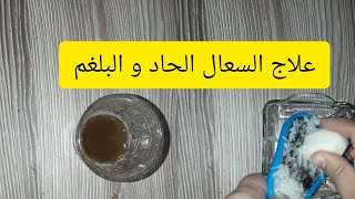 علاجالسعال الحاد و البلغم عند الاطفال و الكبار