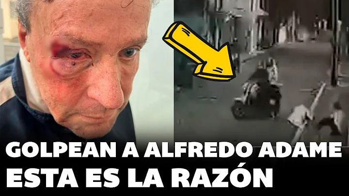 ALFREDO ADAME ES  ATACADO AFUERA DE SU CASA, AS OC...