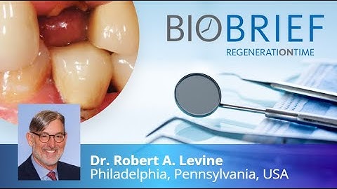 Phenotype Conversion Using Geistlich Fibro-Gide® for Immediate Implants in the Esthetic Zone