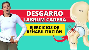 ¿Cómo se comprueba un desgarro del labrum de la cadera?