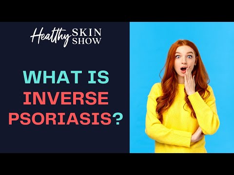 Inverse Psoriasis + Candida Connection