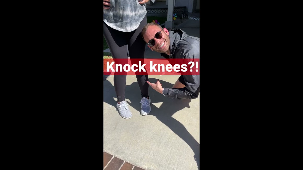 How To Fix Your Knock Knees From Home Grab A Pillow Knockknees Kneepain Walking