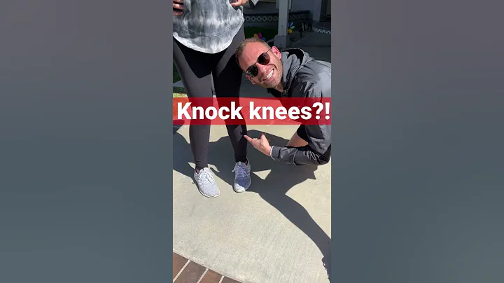 How To Fix Your Knock Knees From Home… Grab a Pillow! #knockknees #kneepain #walking