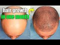 hair growth 1 month : Rice Water recipe for Hair / 1 month hair growth / hair growth in one month