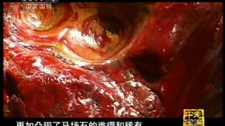 走遍中国 《走遍中国》 20110609 安顺马场石