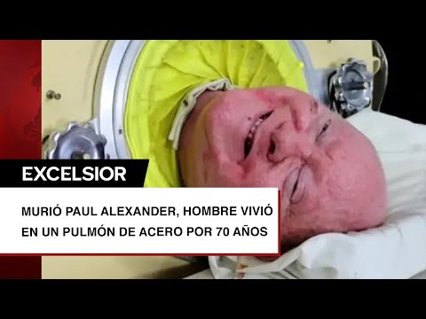 Murió Paul Alexander, hombre vivió en un pulmón de acero por 70 años