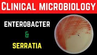 Enterobacter Cloacae & Serratia Marcescens Clinical,Pathogenesis,InvestigationsTreatment, Prevention