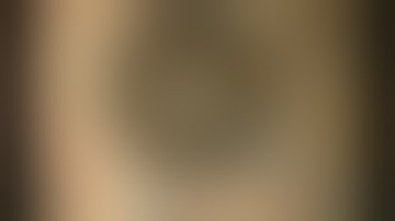 Bleb Revision with the Grover Fellman Sclerostomy Spatula (Malik Y. Kahook, MD)