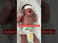 Fat little baby much crying #littlebaby #miraclebaby #baby #premature #newborn #cutebaby #babylove