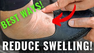 How To Ged Rid Of Swelling After Surgery (7 Ways!)