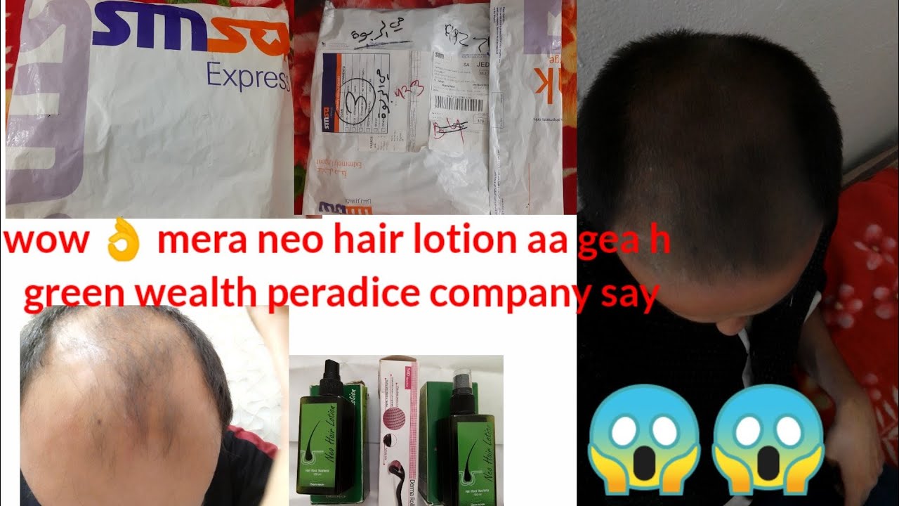 neo hair lotion neo hair lotion original what is neo hair lotion