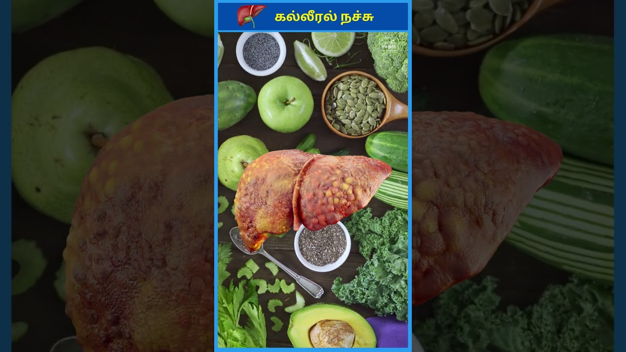 100% Signs of Liver Toxin Overload & How to Detox Naturally