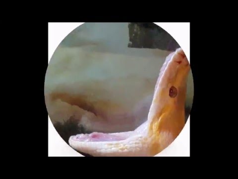 Albino Burmese Python Yawning after feeding