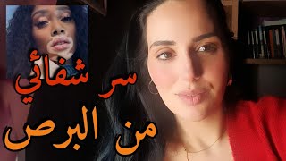 قصة شفائي من مرض البرص