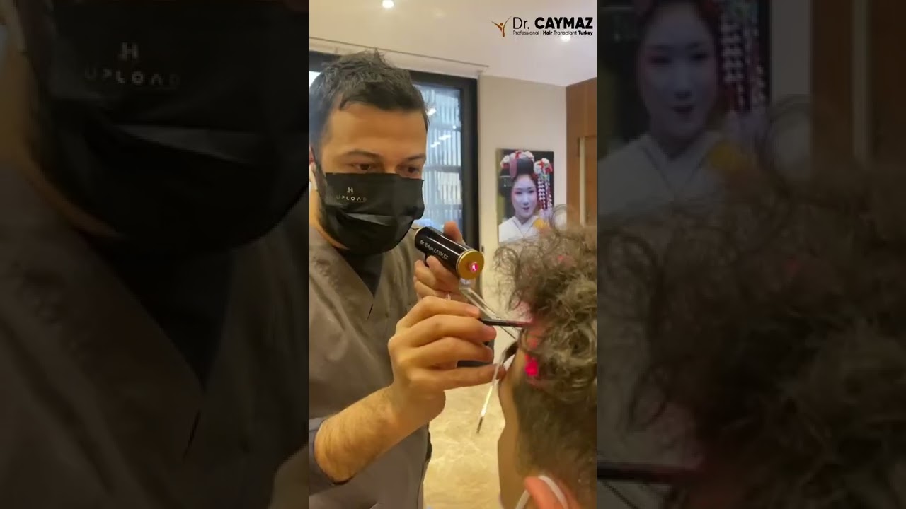 One day: Hair Transplantation in Turkey