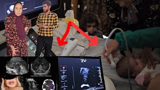 Download Lagu From brain ultrasound to several vital tests; the hopeful journey of Betul and her children MP3 Download Lagu From brain ultrasound to several vital tests; the hopeful journey of Betul and her children MP3